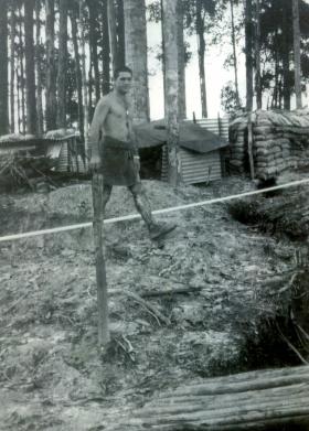 Sgt Allen 'Taff' Alderman covered in jungle sores, Borneo, 1965.